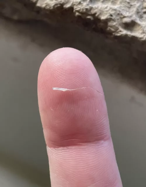 Irritated mustache hair I just pulled. by BEANandCHEE