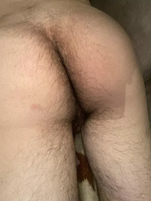 Is it a manass if it doesnt have hair around it? by throwaway1dude