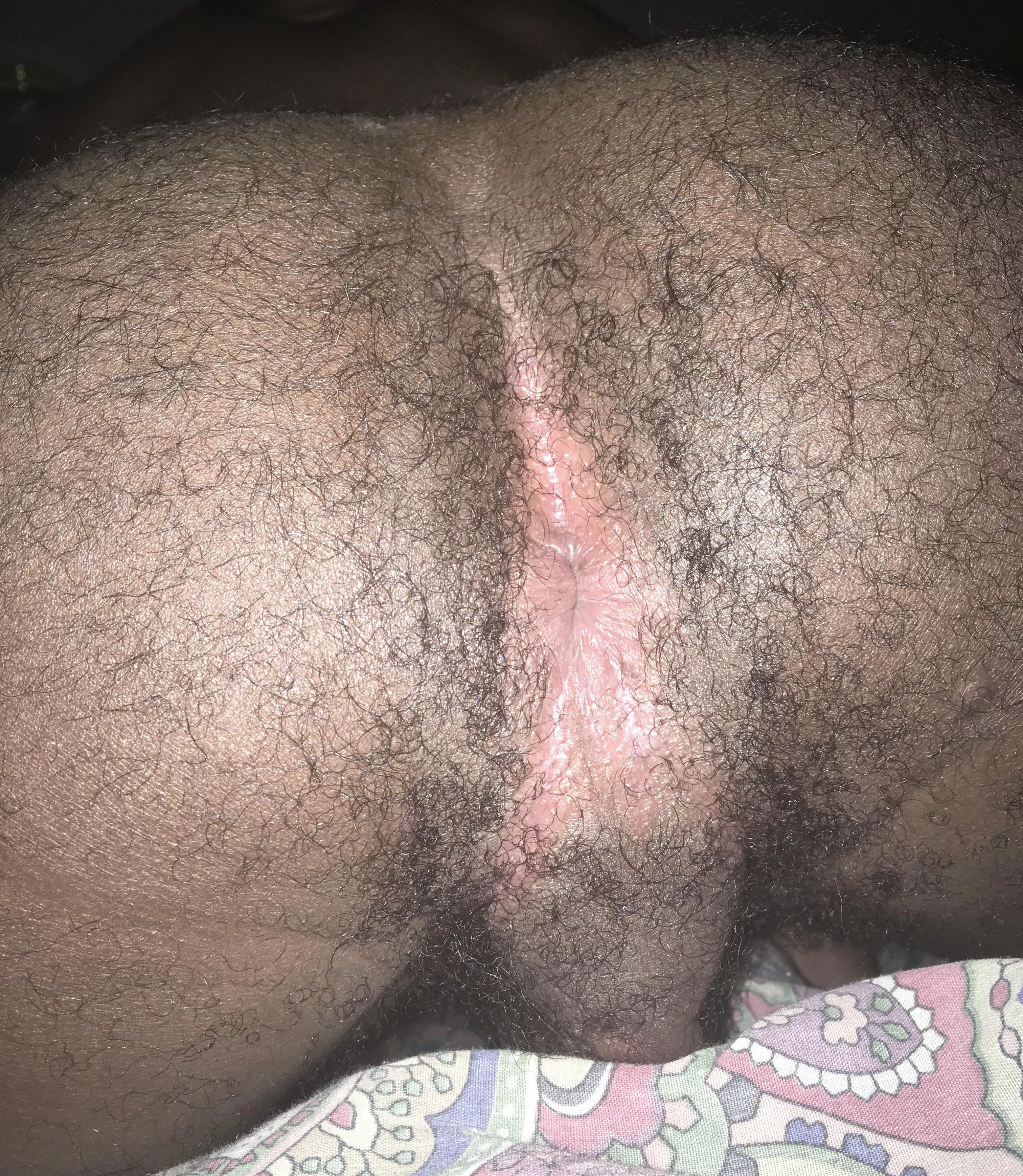 Is this hairy enough? 👀 posted by Greyssmatter