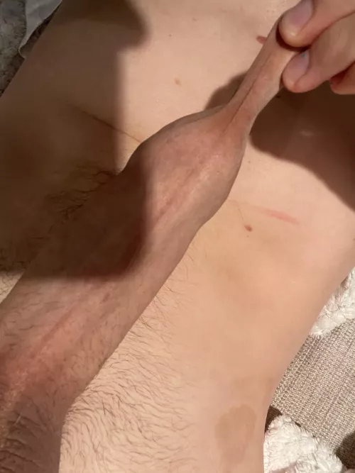 Is this much foreskin a good thing? by CreamyAioli97