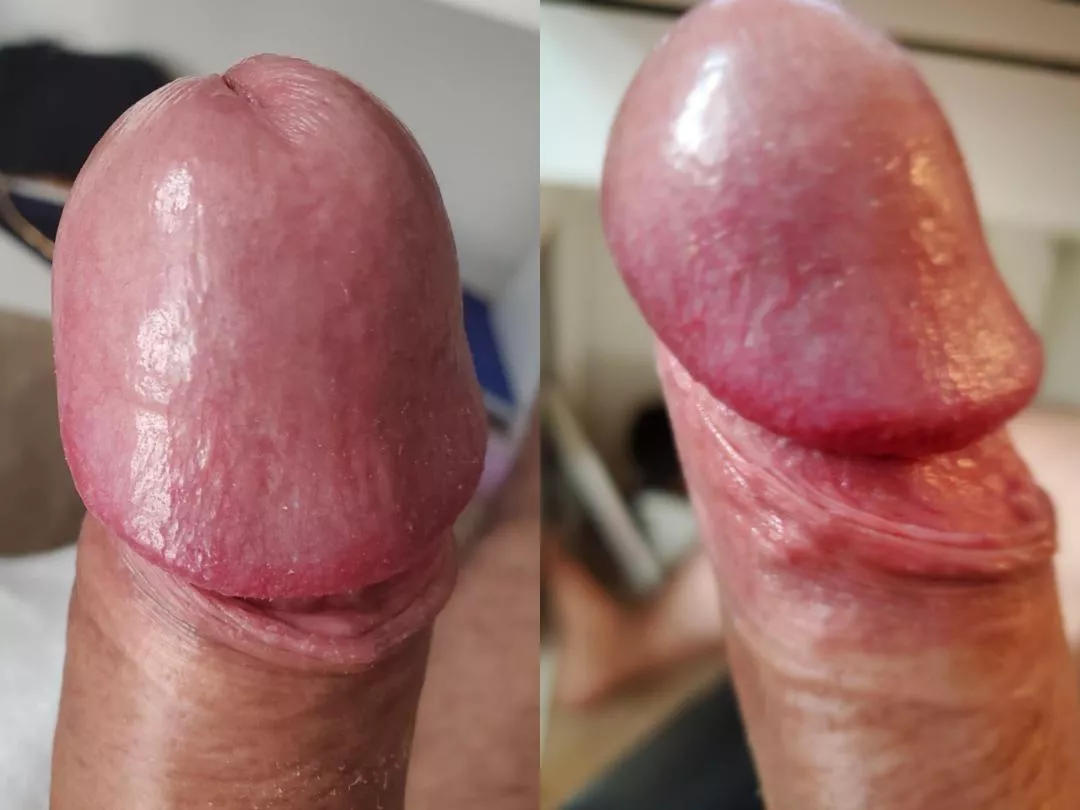 it feels so vulnerable have the head exposed! This is what my tip looks like when I pull down my foreskin. It's pretty photogenic! posted by EchoEchoes