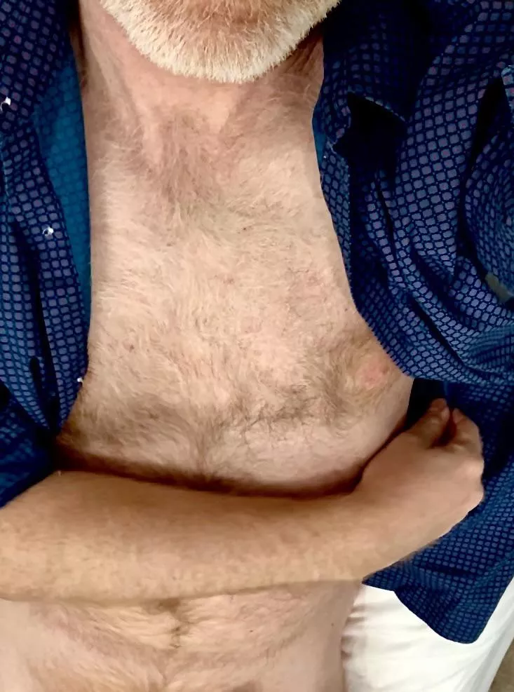 It may not be particularly defined, but it certainly is freckled. posted by ZelaznyFan68