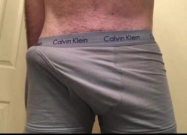 It’s a little noticable posted by krulcity