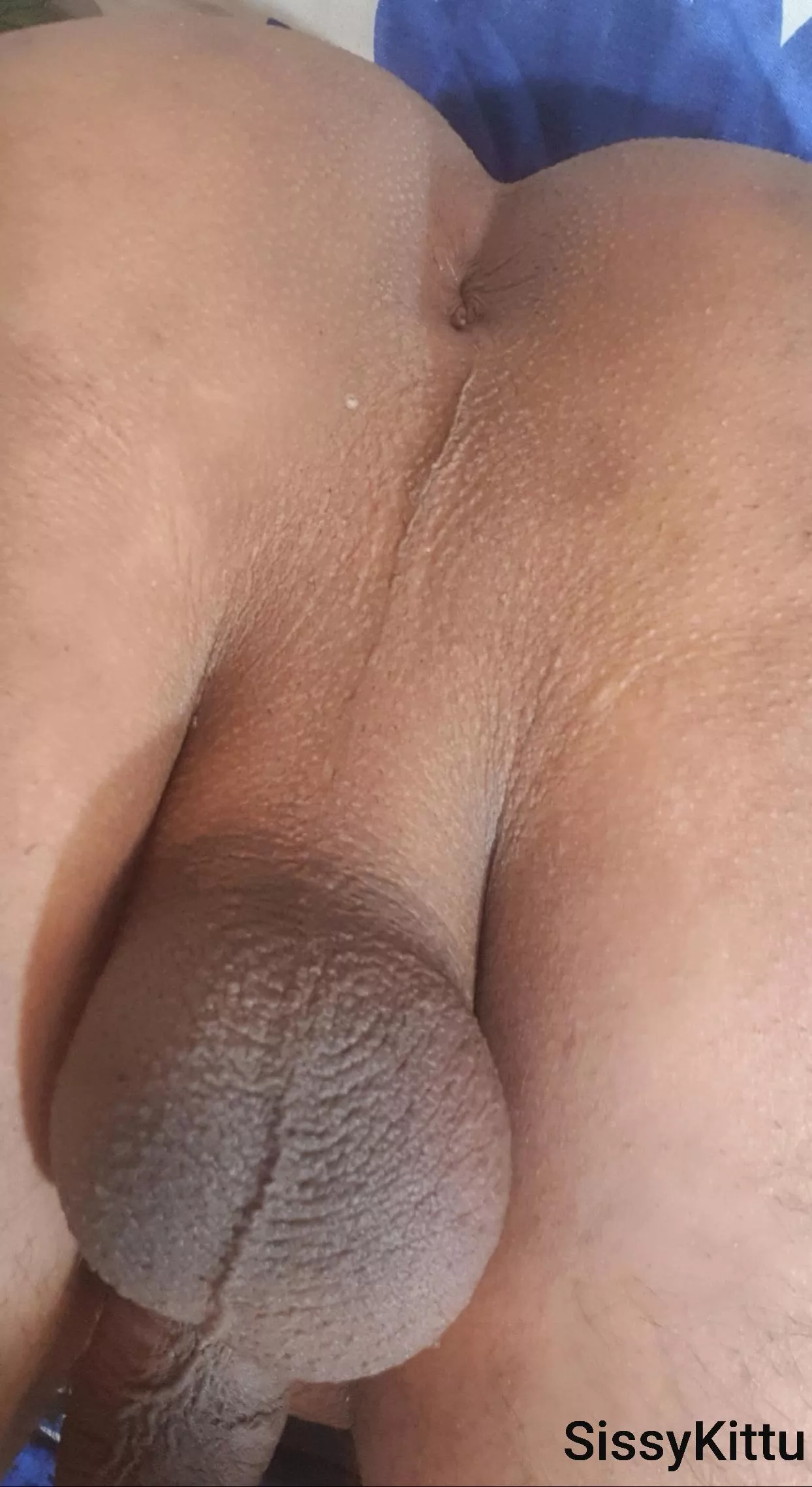 it's itching over there. posted by Xxxguruji