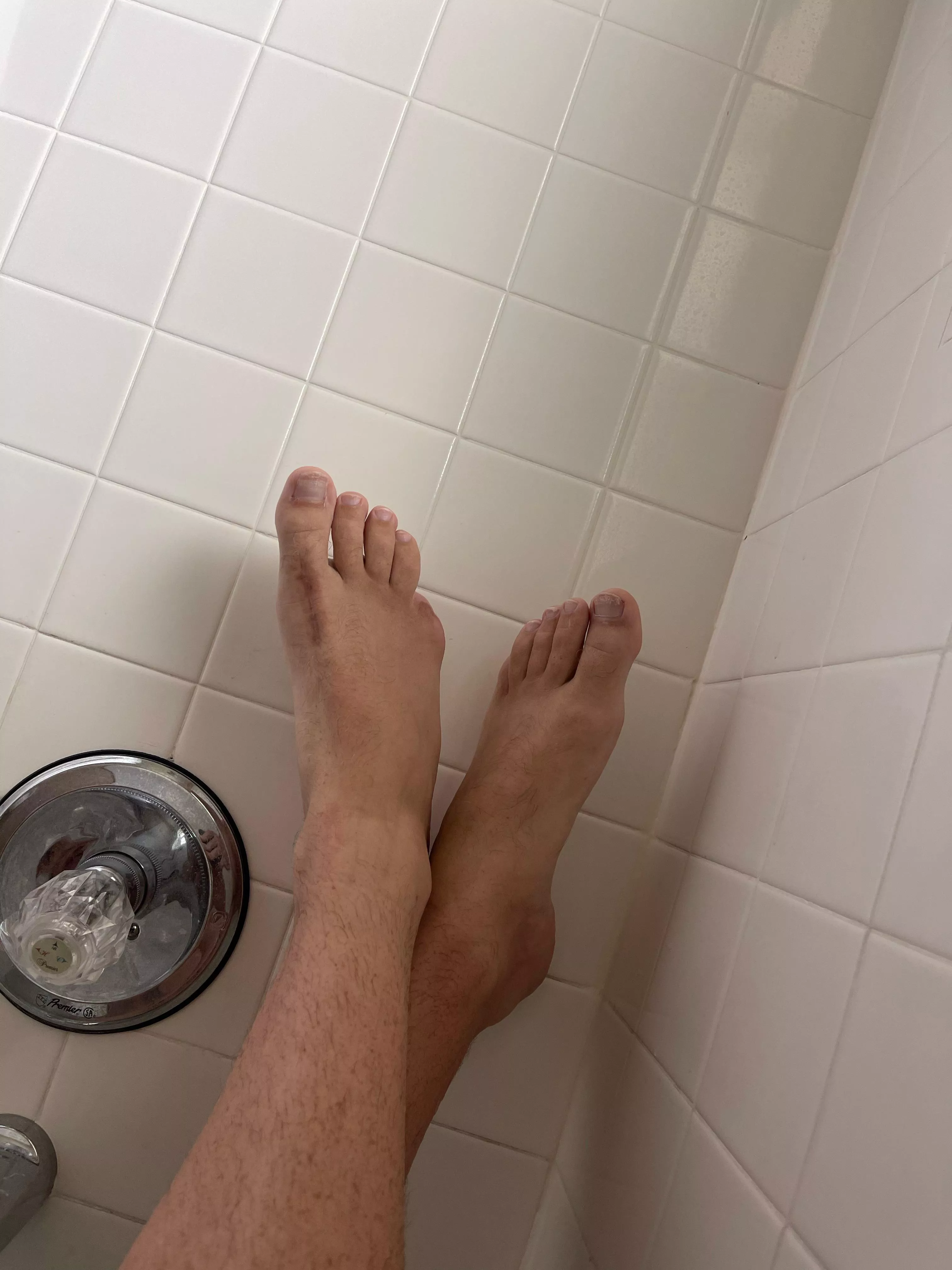 It’s my cake day, so here are my nine toes posted by PriorAssociate1