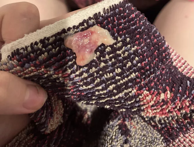 ive been sick for three days and this just came flying out of my nose. I can finally breathe 😭 by br00kethors