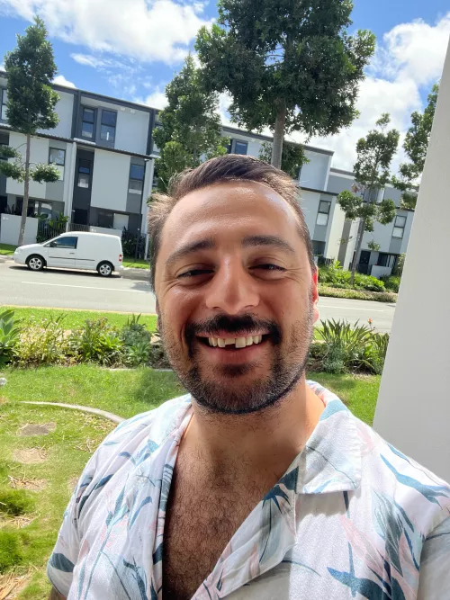 Just broke my cap off my tooth. At least it’s a nice day ☀️ by SteliousKountous