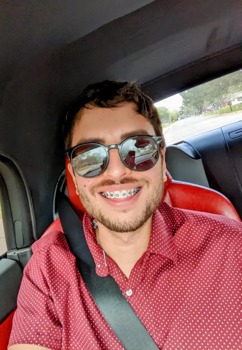 Just got braces at almost 30 years old...trying to embrace them 🤪😁 by xbryandm