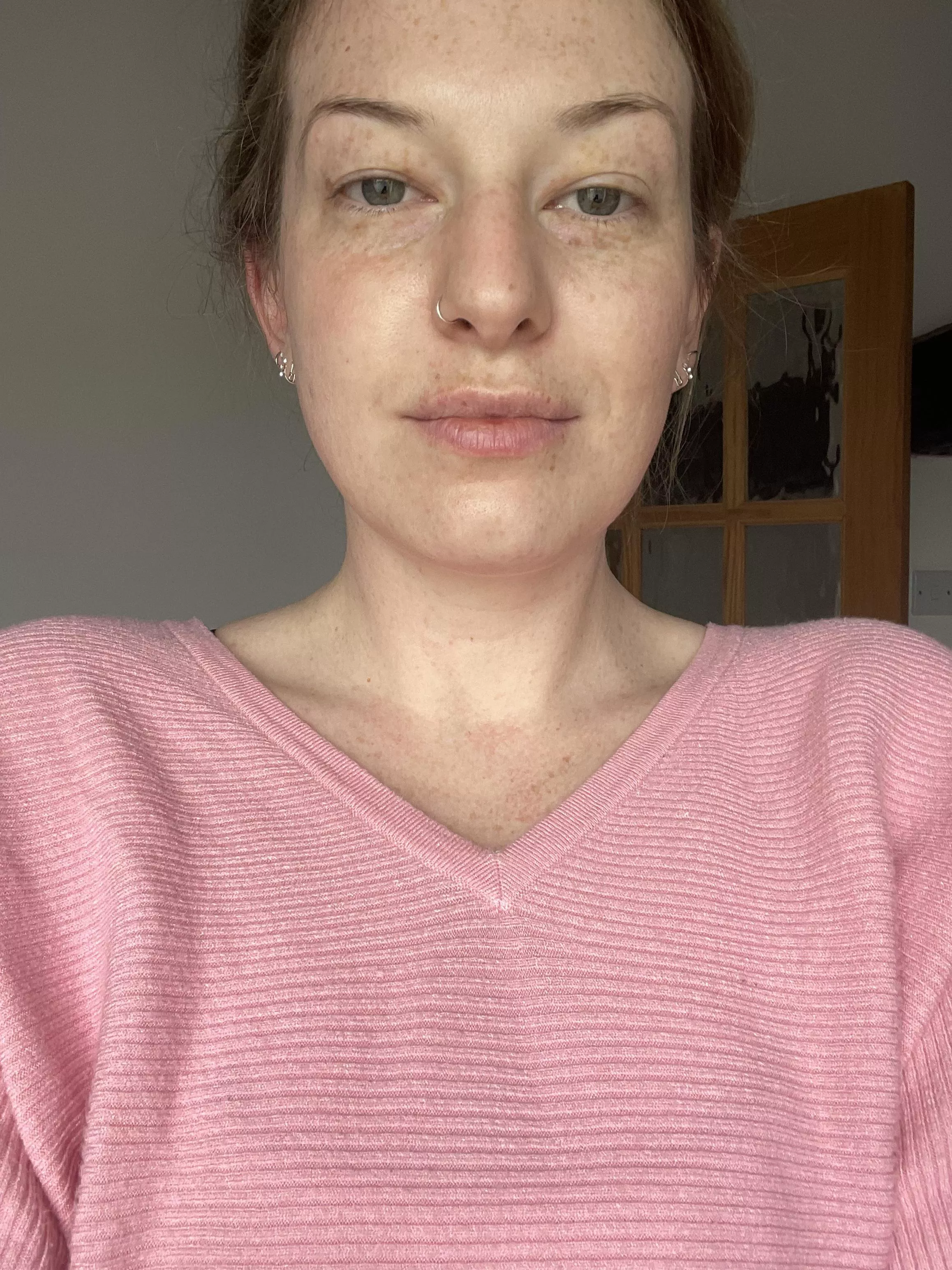 Just my bespeckled face 🥰 posted by LaceyFreckles