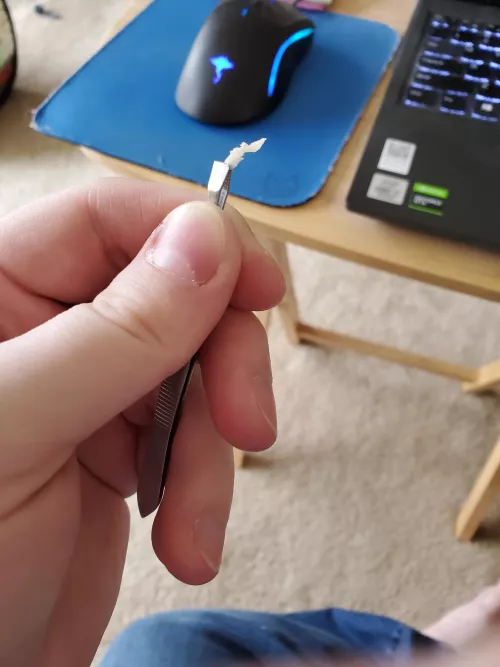 Just pulled this big ingrown piece out of my big toe! It's part nail, part hardened skin! Instant relief! by Gato1486