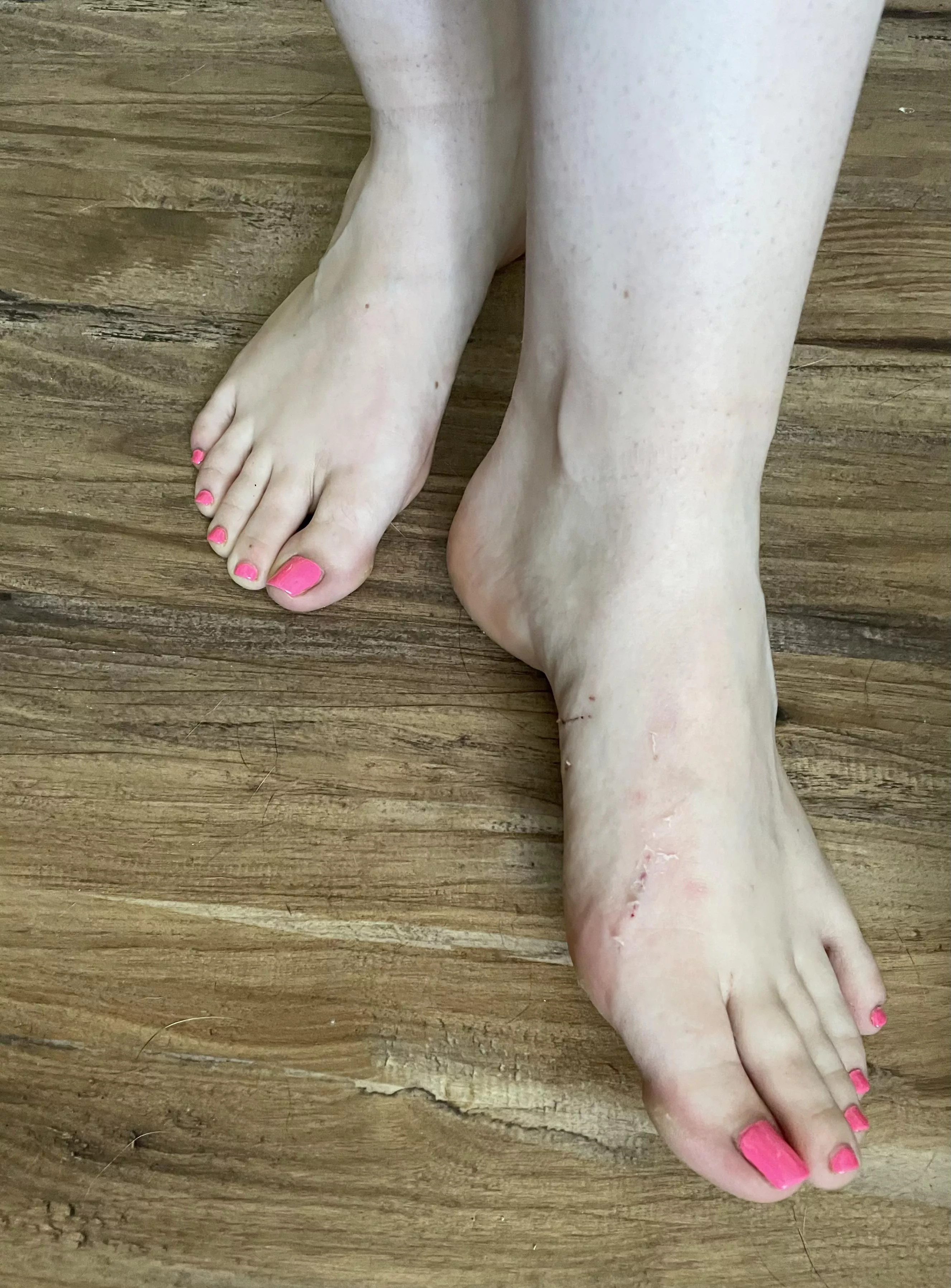 Just scratched my foot on a gate, will you still like them? posted by raynes_panty_drawer