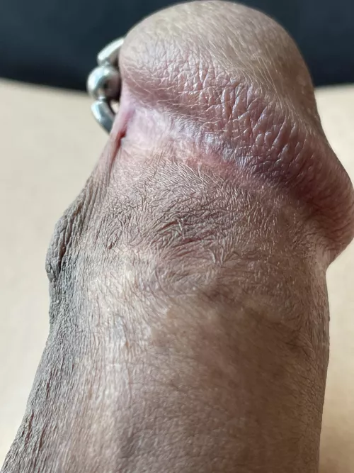 Keratinised patterns. by princealbertfan