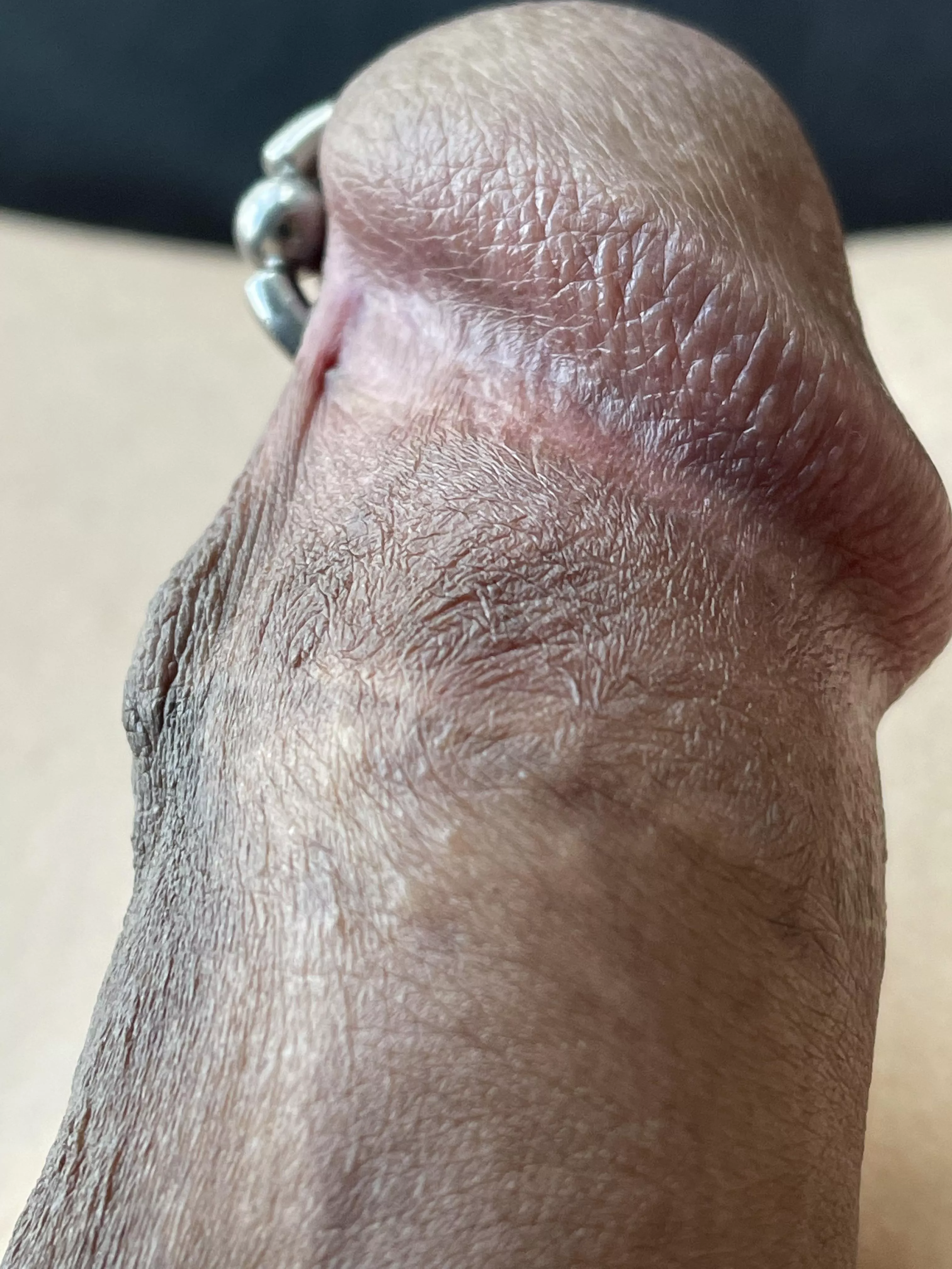 Keratinised patterns. posted by princealbertfan