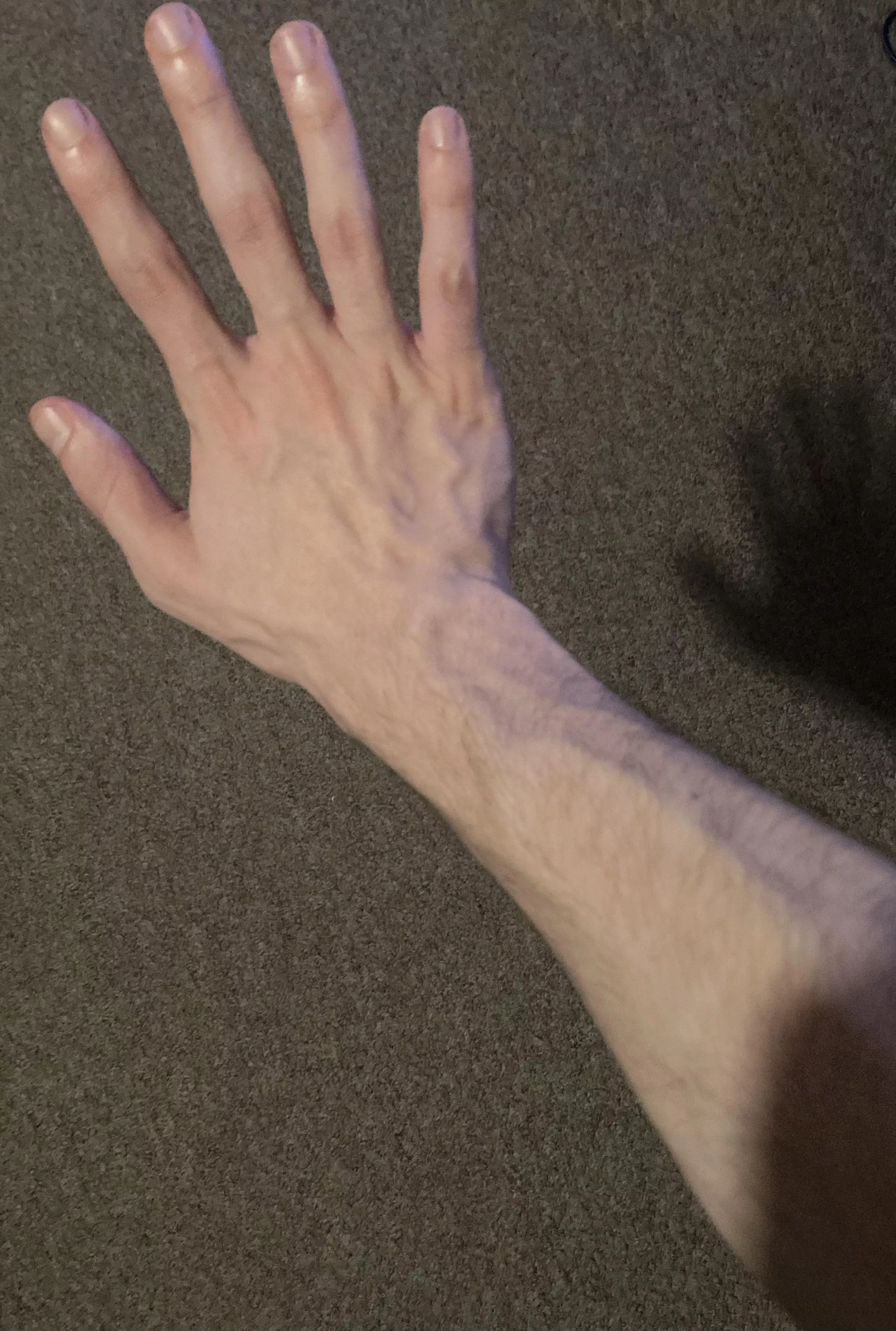 Late night veins posted by anon47851790