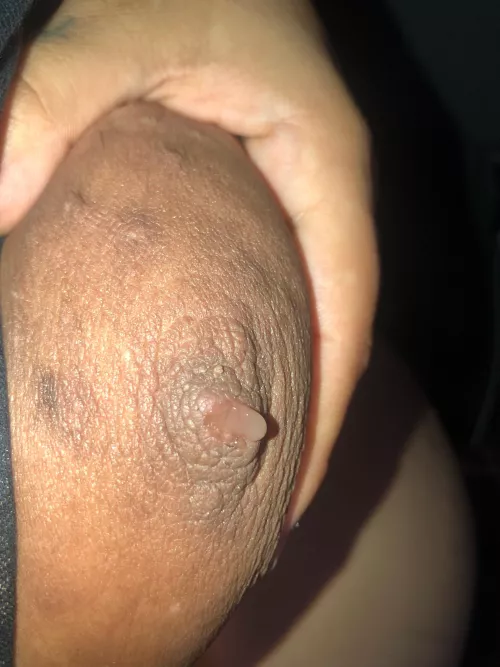 Leaking at 19w😩 by Even-Biscotti2041