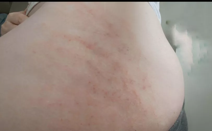 Left me with more than just a mark ✋🏻 what else would you do ? by StrengthPretty892