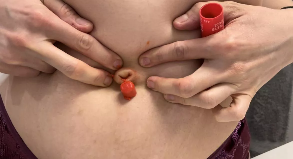 Lip gloss broke off while I was fucking my belly button with it posted by BUBBLEGUMBIITCH