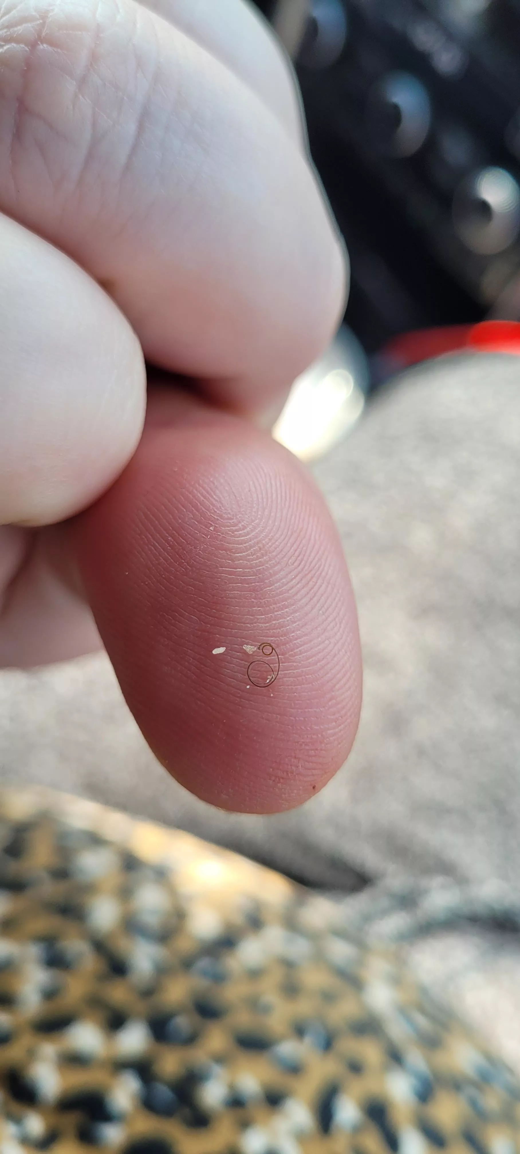 Little curly hair I pulled from my chin! posted by Professionalpharm