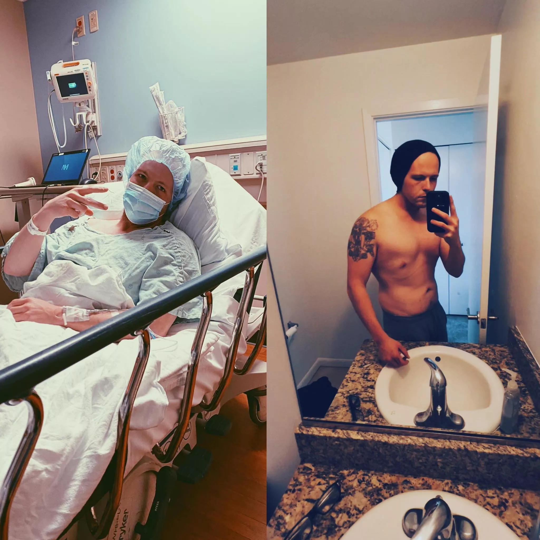Little progress and wild after hernia surgery (m) posted by kofitnesstoday