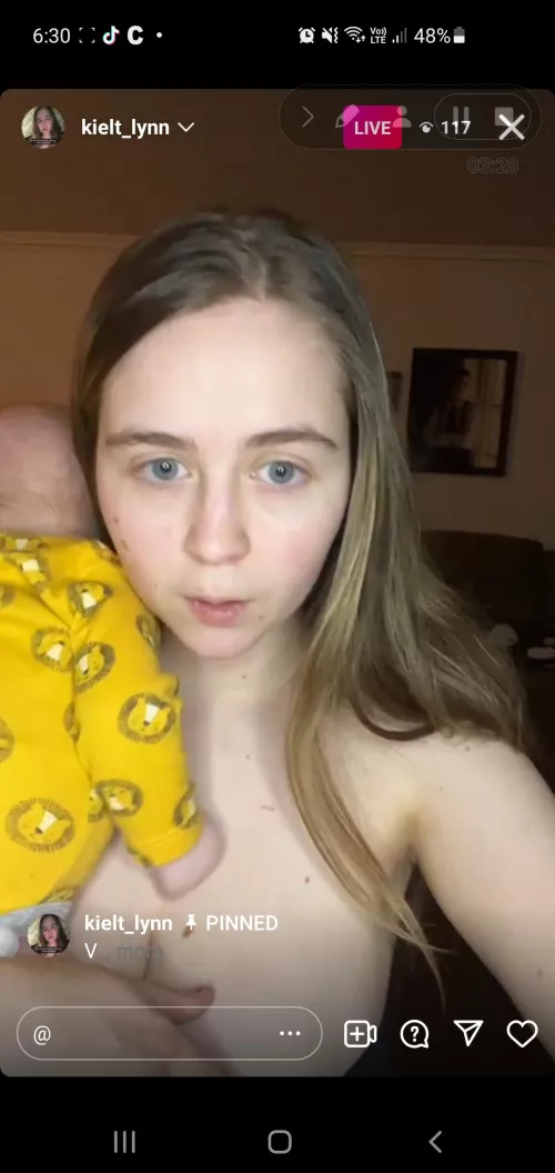 live rn by Smart-Ear-1552