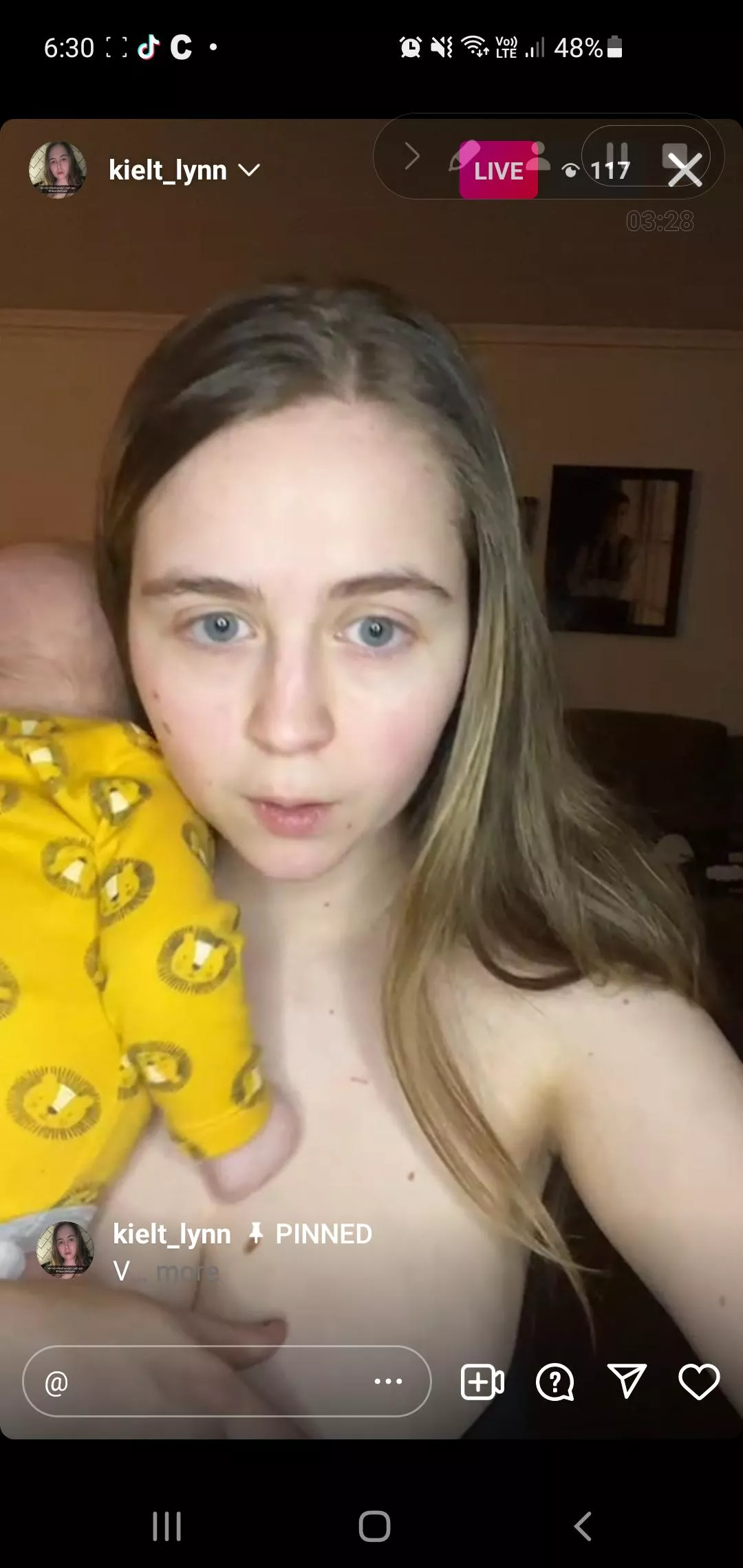 live rn posted by Smart-Ear-1552