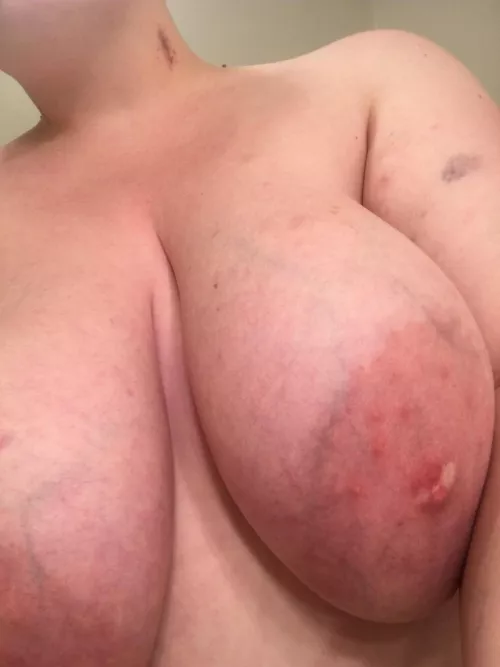 lol oops by huckle_baby