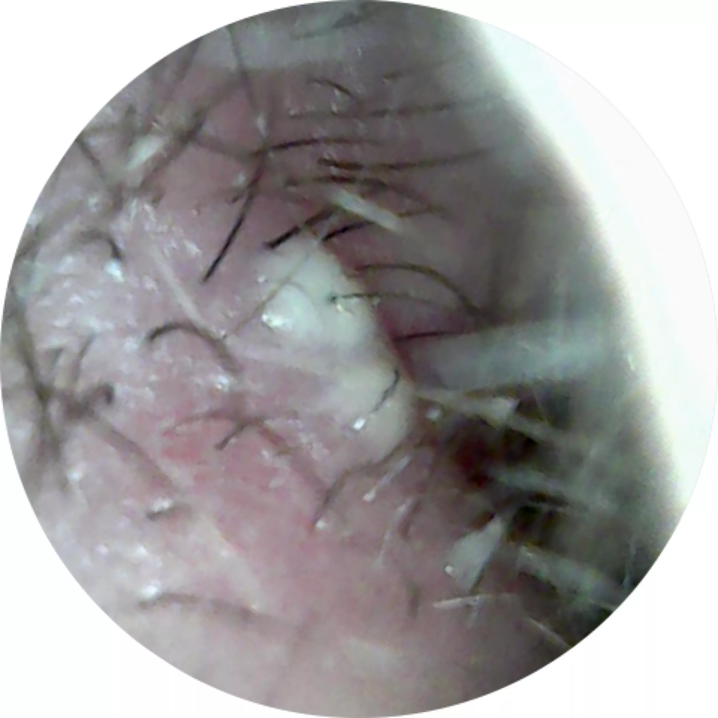 Long time lurker first time poster. Double nostril pops that I just can’t get. The frustration is unbearable! posted by SnowflakeGuinea