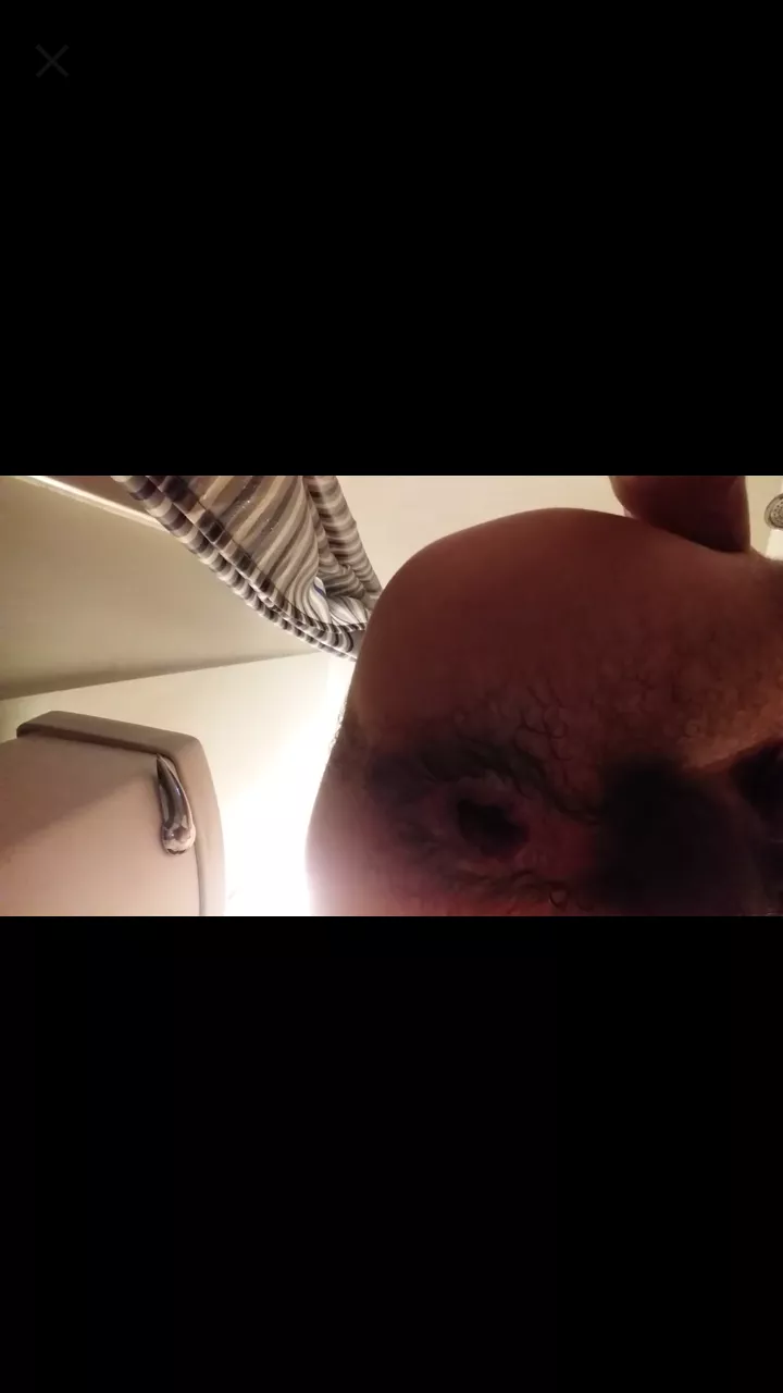 Loose man puss posted by ZealousidealShift665