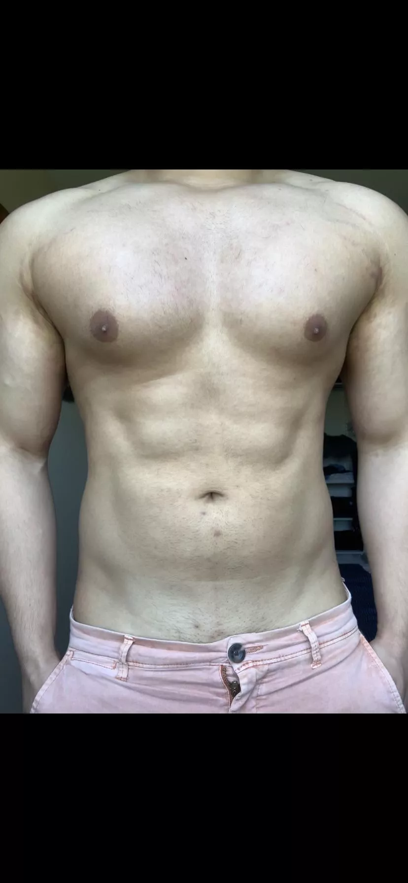 [m] Chest pump posted by Small-Pie-1507
