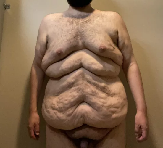 M/26/295 This is my body after losing 125 lbs. I’d choose this body over being +400 lbs any day. The fat roll between my chest and stomach was caused by stomach gripping for the last 16 years. by bpany96