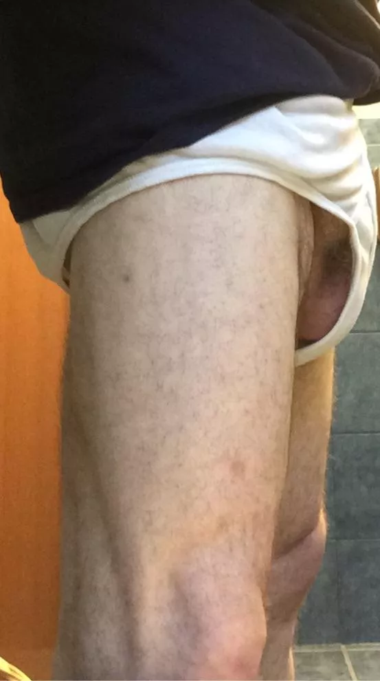 Many people have mentioned that my briefs look loose. They are. I worked hard to lose a lot of weight and so now they are Bacci. Here is a close-up so you can see just how baggy. posted by Unique-Room-7012