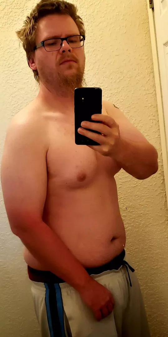 May have gotten some sun yesterday. Any gal got some aloe? posted by thiccnessislife