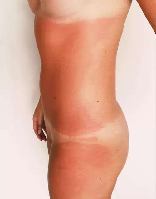 Maybe a little too much sun [f] by Aquagirl_sa