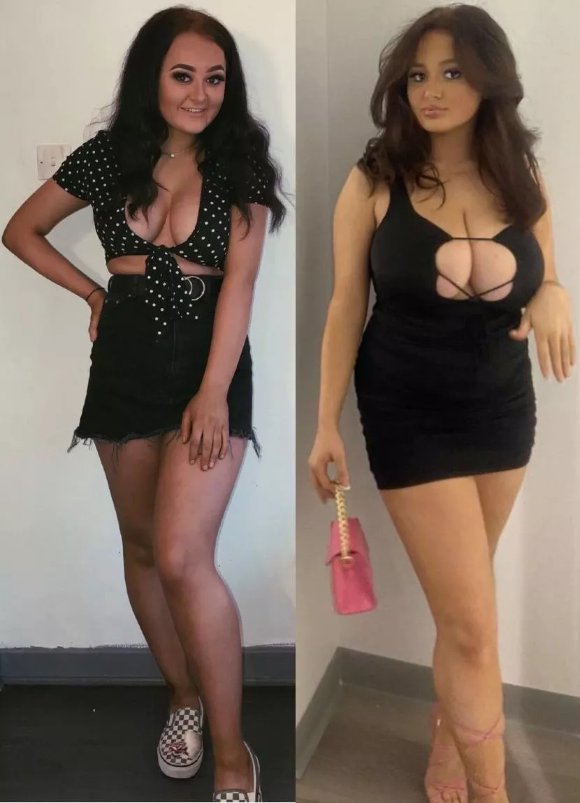 Mia.ely huge breast growth posted by TittyScout