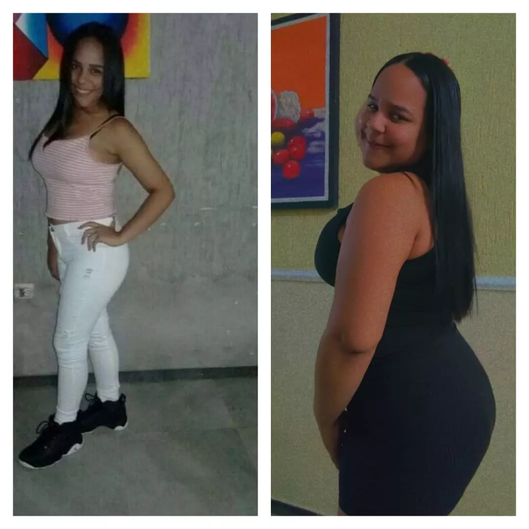 my before and after is totally amazing🤩 posted by reddijennibroms