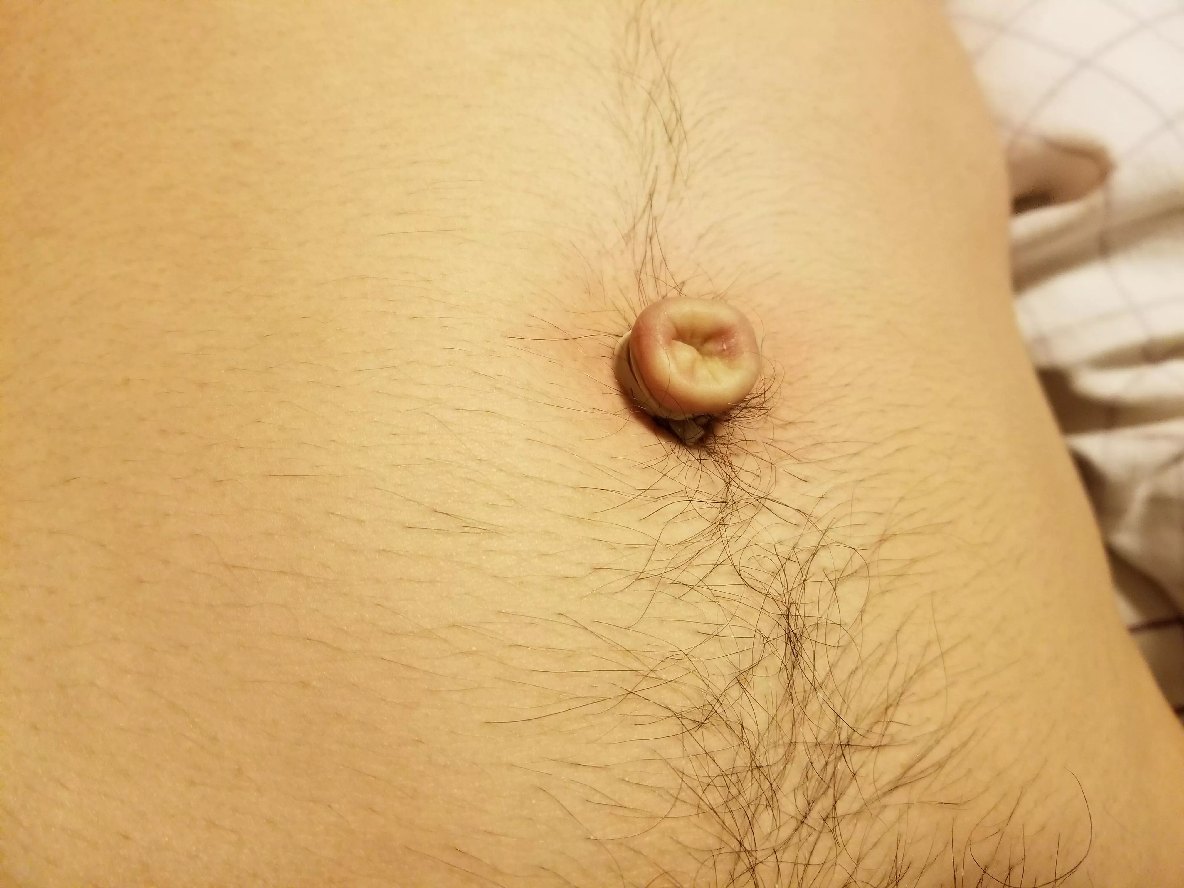 My belly button turned into an outie with a rubber band. 😃 posted by Piccolo_Bass