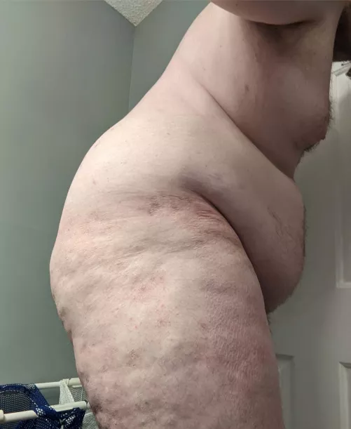 My Belly Hangs So Low Now... by beyondthreehundred