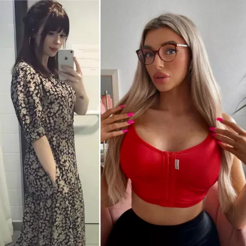 My bimbo transformation so far. New tits ✅ New lips ✅ New hair ✅ New nails ✅ New physique ✅ and more to come 🥰 by Bethvolio_extras