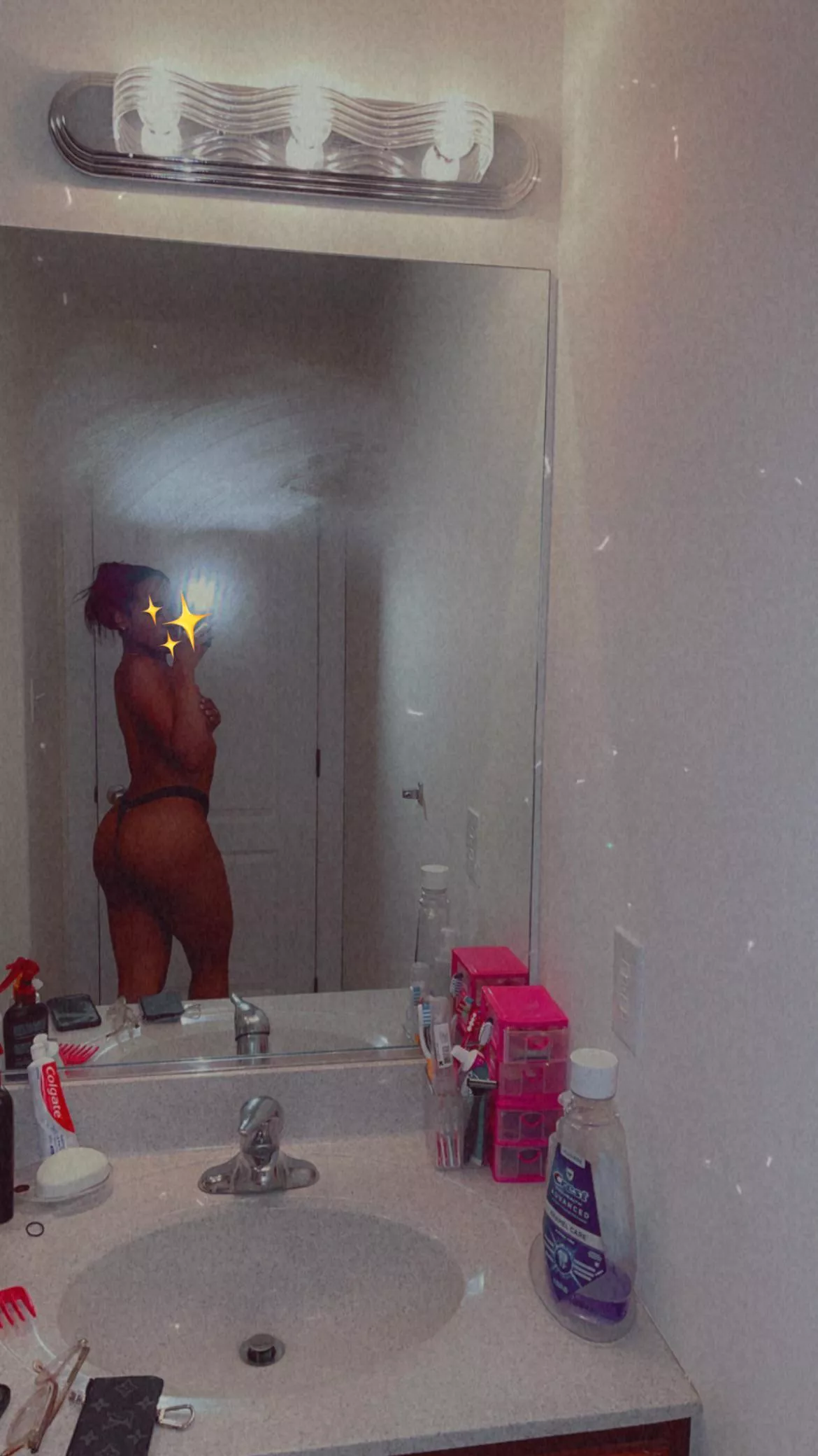 My dog bit me now it hurts right there ;) posted by Theaardvark93