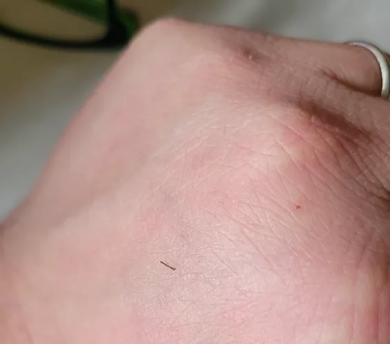 My ear has been itching like crazy for a few days, i could feel something in there, and managed to tweeze out this little tree trunk of a hair. by DevilsInTheJukebox