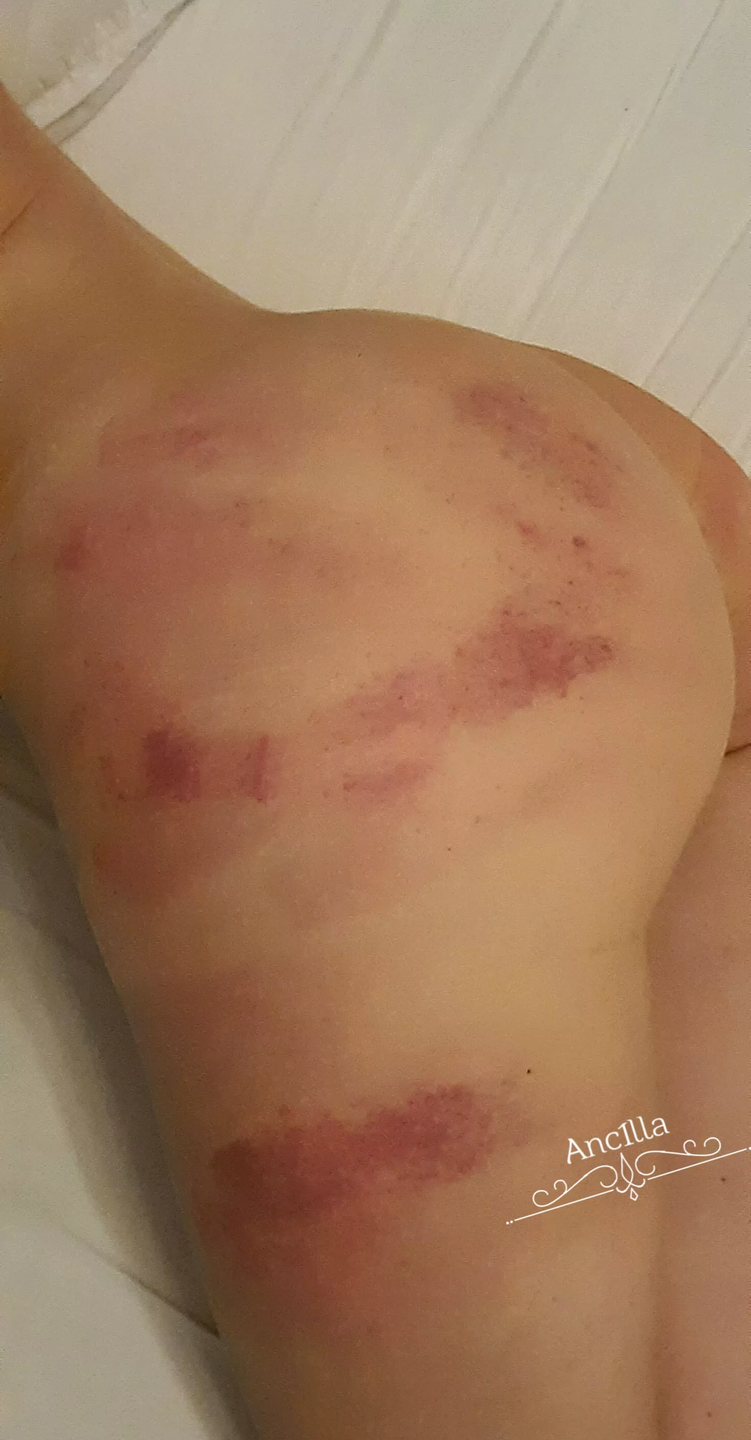 My favorite kind of jewelry ❤ [F] posted by anc1lla