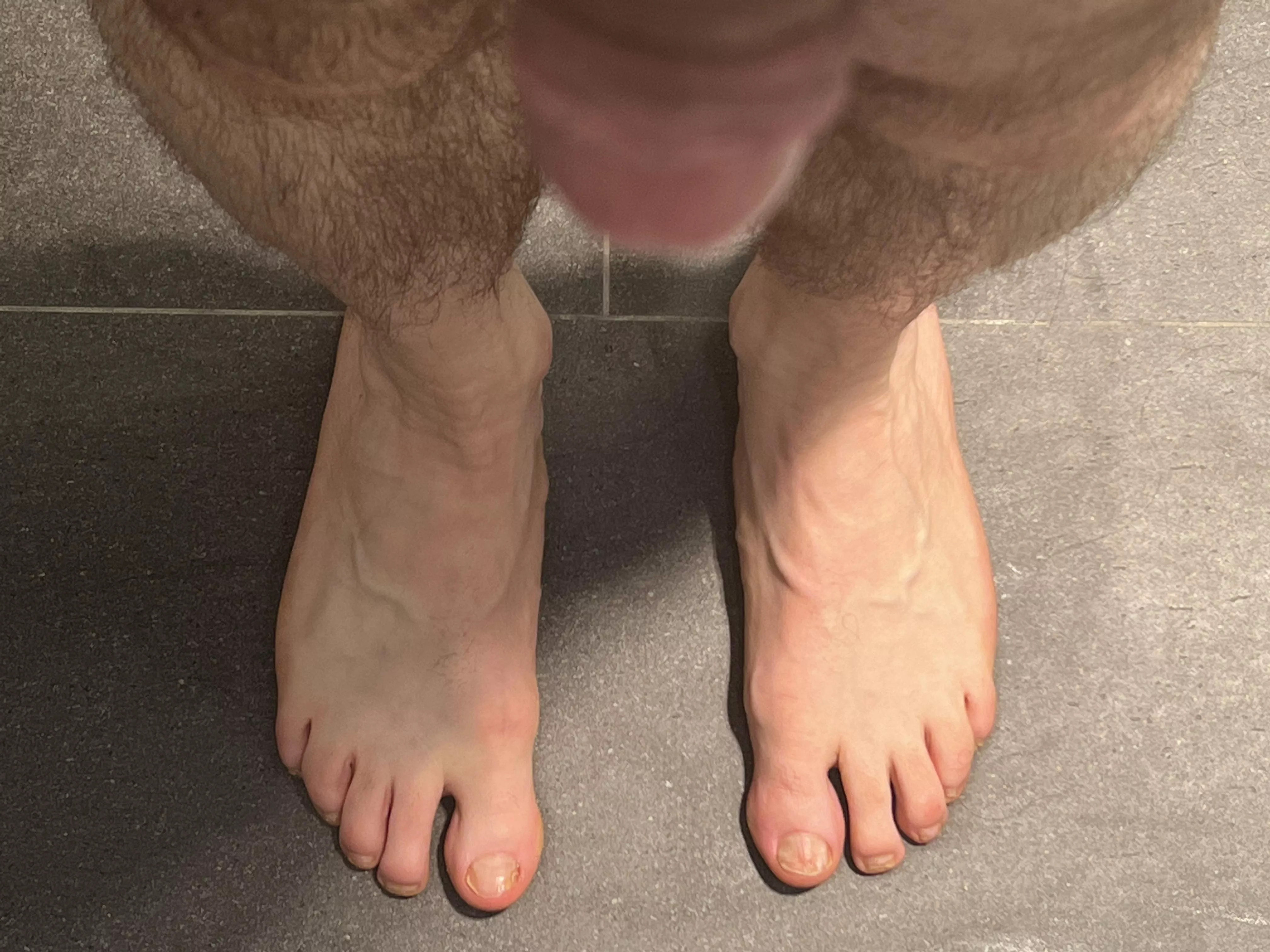 My feet today posted by hmmcock