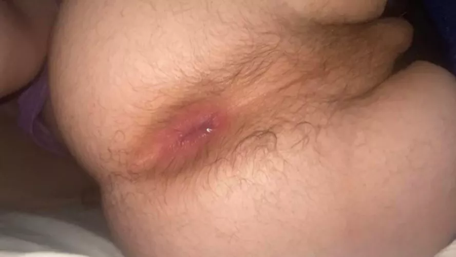 my hole after playing in it😋 by plaid-shirt-days