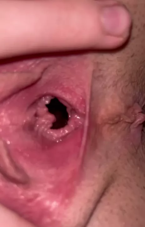 My hole is so stretched out! Do you want me to open it wider for you? posted by Glad-Ad148