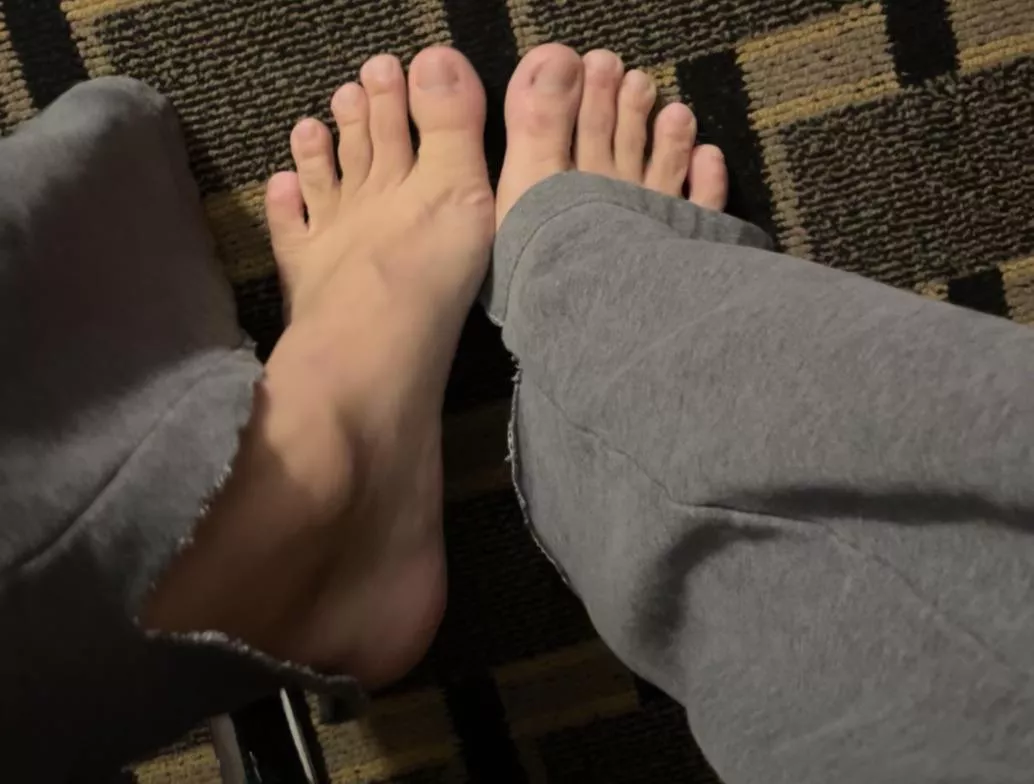 My hotel feet posted by Harrypotskins1