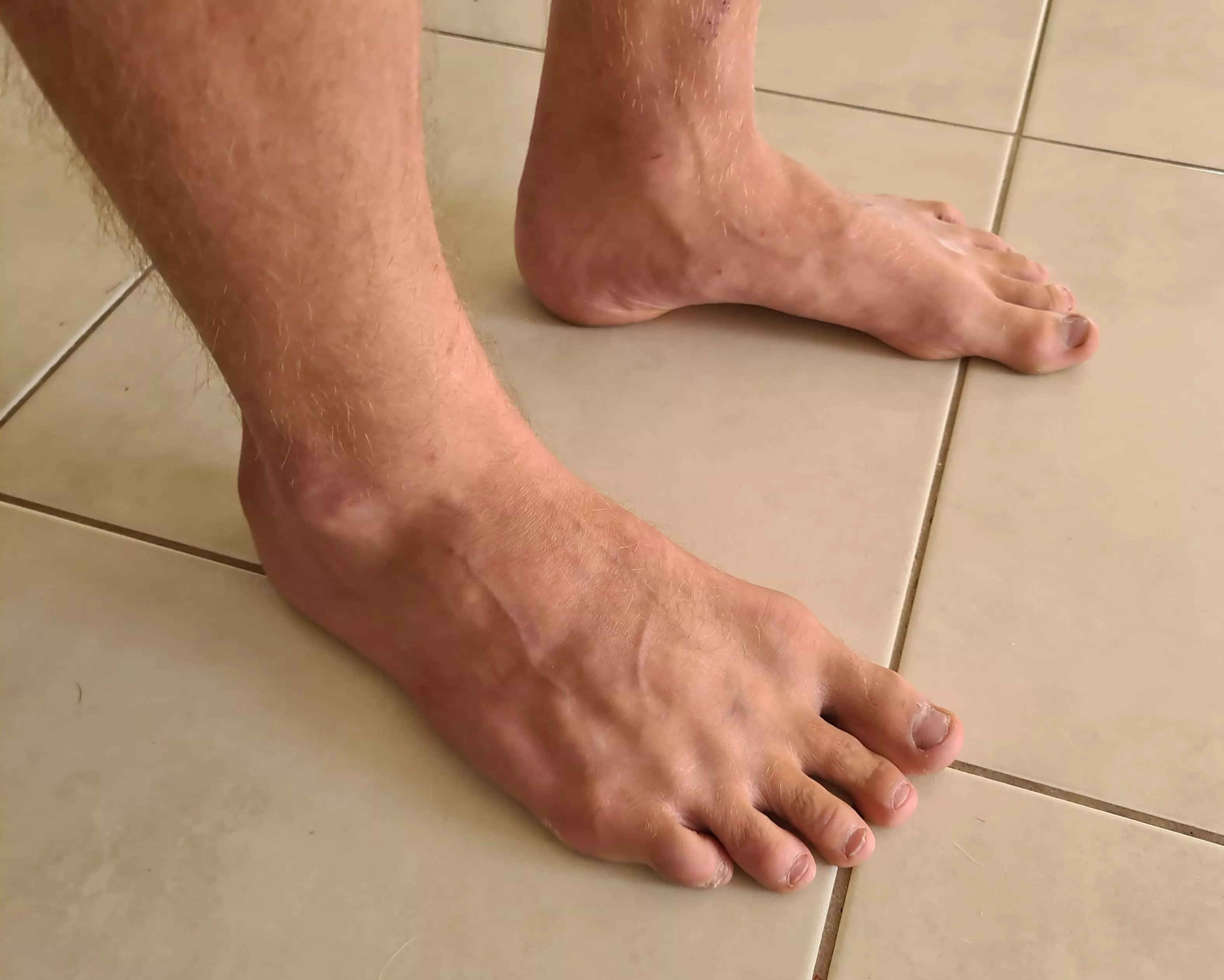 My nails need a bit of attention...;) posted by alecnysten