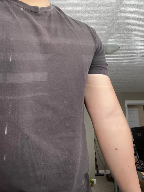 My normal arm by bugnuggie