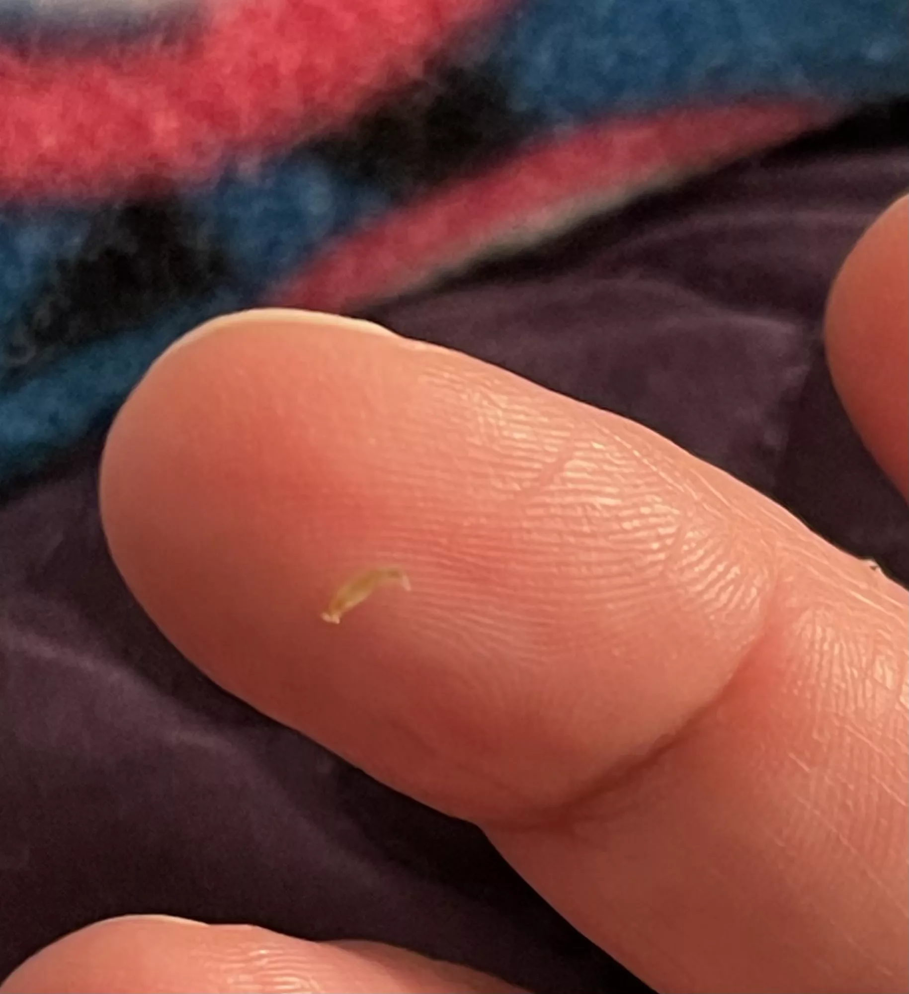 My son had a laparoscopic surgery when he was an infant. Every now and then, 10 years later, the tiny scar fills up and gets a black head. Got this cute little thing out of it just now! (No children were harmed during the squeezing) posted by Prockles