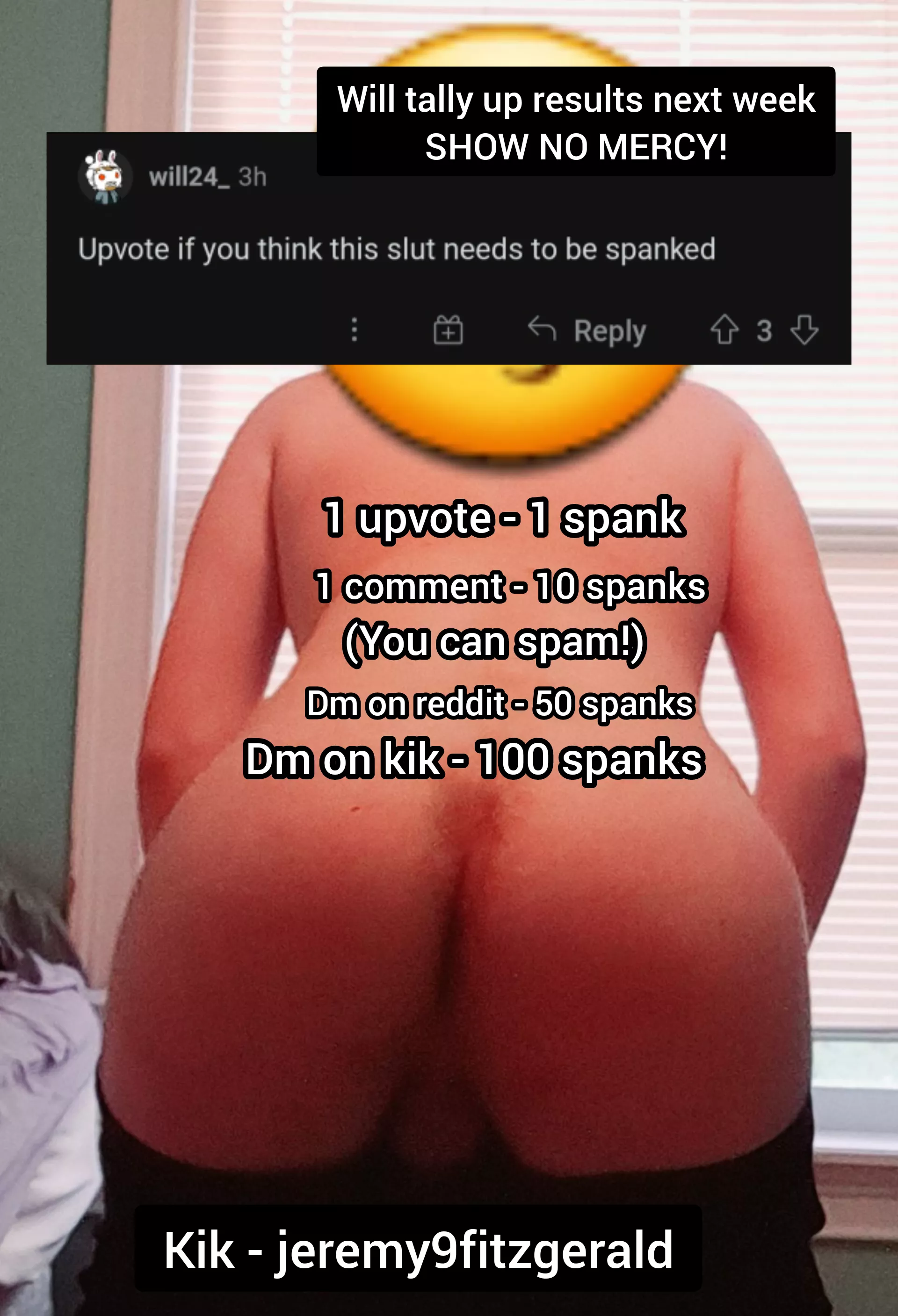 My soon to be bright ass, will post here and a video on my profile next week! posted by bubblebuttspankslut7