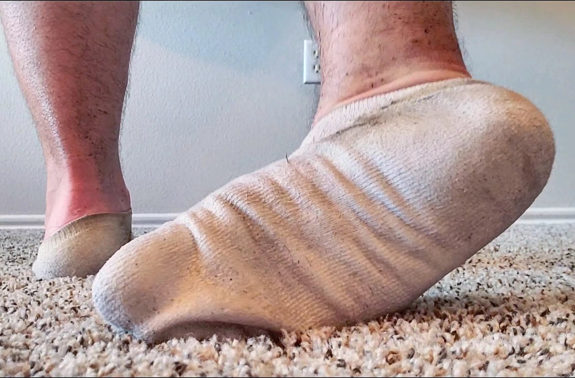 My sweat soaked 30+ day old socks after a run posted by Sckb4u